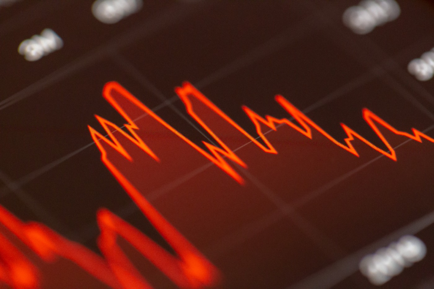 Celcoin compra a VERT Capital e entra no mercado de capitais